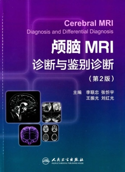 颅脑MRI诊断与鉴别诊断封面图