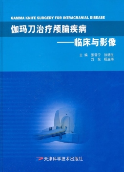 伽玛刀治疗颅脑疾病封面图