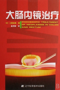 大肠内镜治疗封面图
