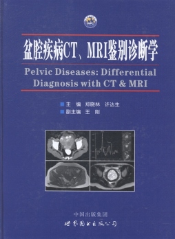 盆腔疾病CT、MRI鉴别诊断学封面图