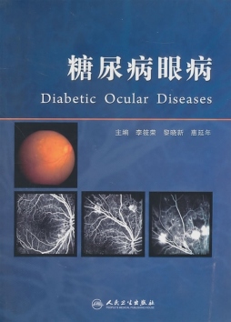 糖尿病眼病封面图