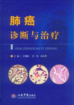肺癌诊断与治疗封面图