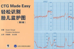 轻松识别胎儿监护图封面图