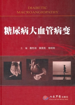 糖尿病大血管病变封面图