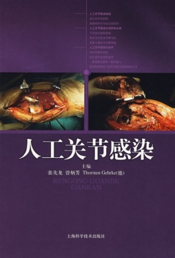 人工关节感染封面图