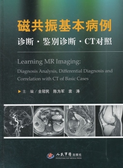 磁共振基本病例封面图