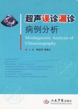 超声误诊漏诊病例分析封面图