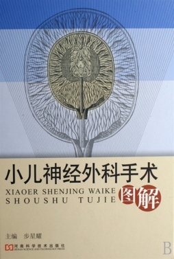 小儿神经外科手术图解封面图