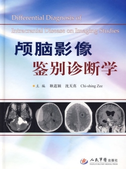 颅脑影像鉴别诊断学封面图