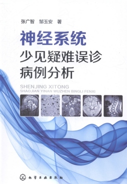 神经系统少见疑难误诊病例分析封面图