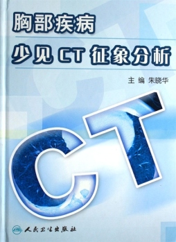 胸部疾病少见CT征象分析封面图