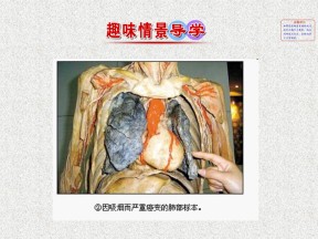 2019-2020学年苏教版选修1-2     独立性检验     课件（33张）